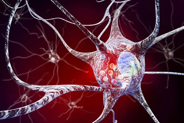 Parkinson's Disease Detection